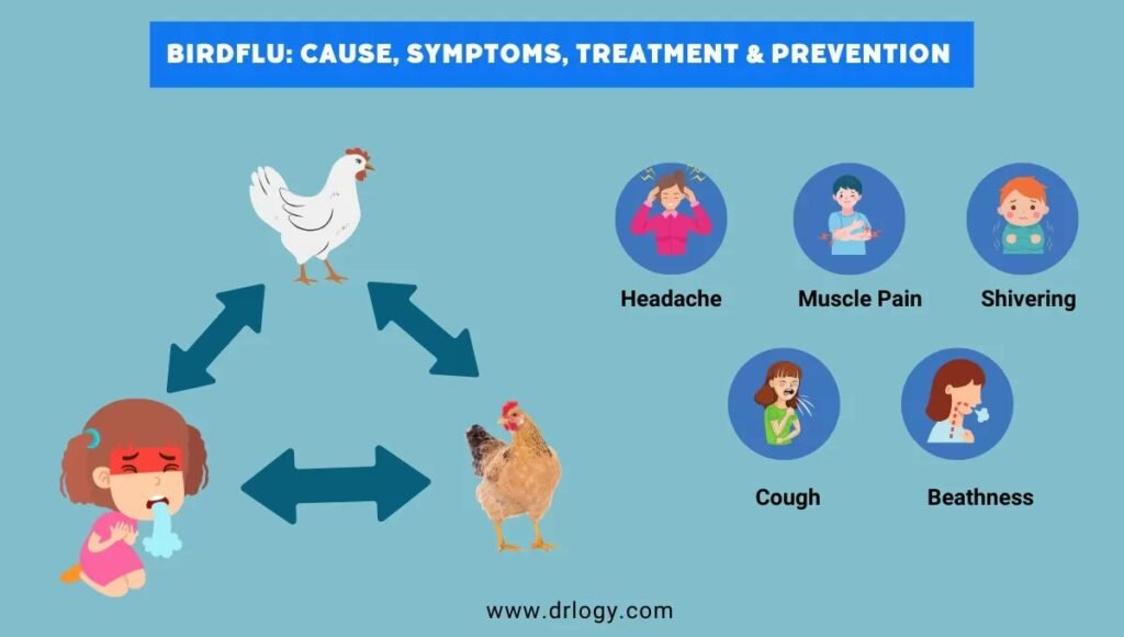 Avian Influenza